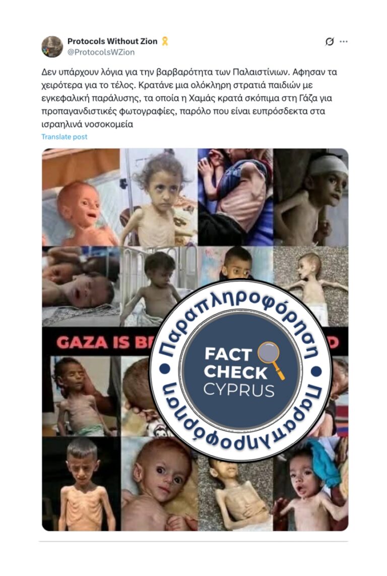 Όχι, ο λιμός στη Γάζα δεν περιορίζεται σε παιδιά με αναπηρίες